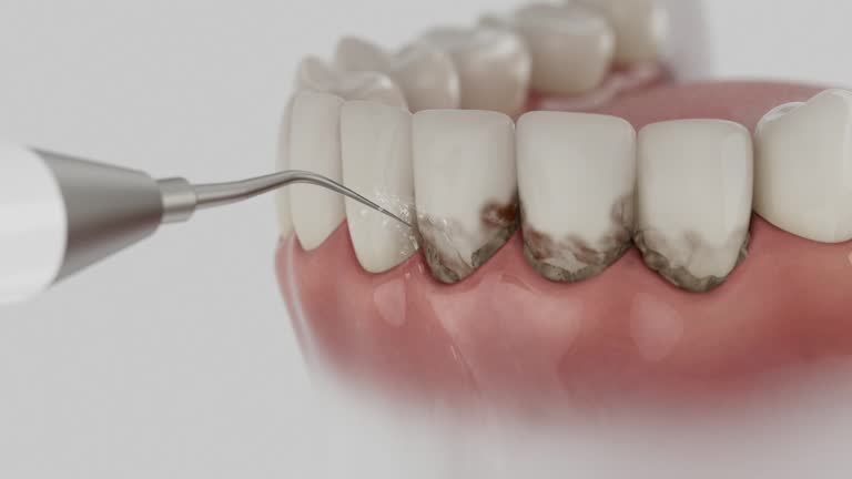 Trusted Teeth Cleaning And Checkup service in Wickes, AR - Dentist Open Now
